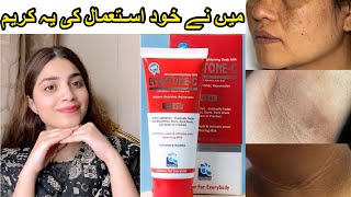 Eventone c cream  How to use  side effects  drreview in detail  medicated whitening cream [upl. by Aihsiym]