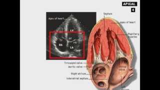 Echocardiography Introduction [upl. by Eniluj]