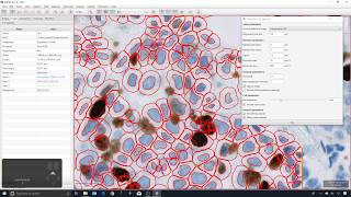 4  Cell detection vs Positive cell detection [upl. by Mungam]