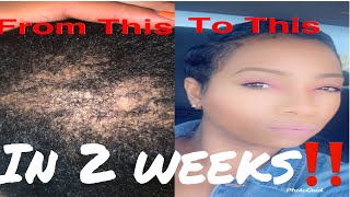 2 Week Hair Growth Routine Hair Growth Tips I WAS BALD SIS‼️ [upl. by Gennifer]