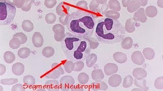 Understanding Leukograms in Veterinary Medicine [upl. by Alaet191]