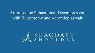 Arthroscopic Subacromial Decompression with Bursectomy and Acromioplasty [upl. by Novyat]