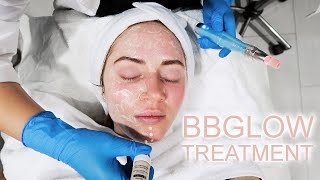 BB GLOW TREATMENT For instant fairness Glowing skin at Zarpash Khan Beauty Clinic [upl. by Leland707]