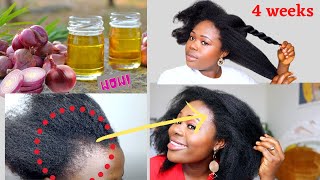 Grow Hair in 4 weeks with Onion Oil home made onion oil for rapid hair growth [upl. by Mariko]