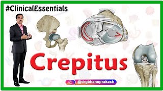 Crepitus of the Joints  Clinical essentials [upl. by Adnwahsat]