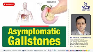 Asymptomatic or SymptomLess Gallstones  All you need to Know [upl. by Yob]