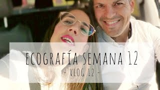 VLOG 12  ECOGRAFÍA SEMANA 12 [upl. by Ahcorb302]