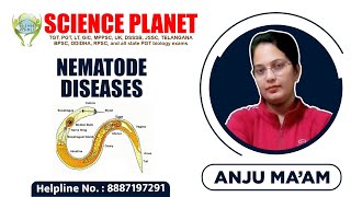 Nematode Diseases Explained by Anju Mam of Science Planet [upl. by Hallagan]