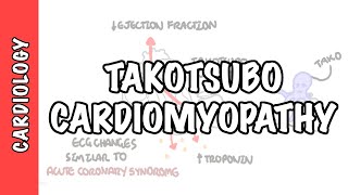 Takotsubo Cardiomyopathy Broken heart syndrome  pathophysiology diagnosis and treatment [upl. by Nnyroc]