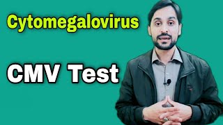 CMV Test  Cytomegalovirus Test [upl. by Trillby]