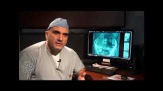 Uterine Fibroid Embolization  Dr Mel Ghaleb [upl. by Zipporah]