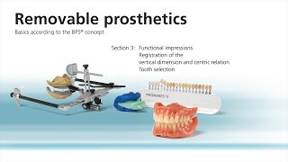 Removable prosthetics workflow 37 – Second clinical appointment [upl. by Gebhardt]