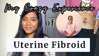 Massive Fibroid Tumors Journey  My Symptoms Diagnosis and LapMyomectomy IT HAPPENED TWICE [upl. by Acassej]