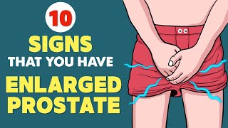 Enlarged Prostate BPH  Signs amp Symptoms  Every Man Needs to Know This [upl. by Salvatore]