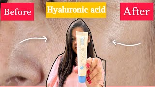 HYALU GEL HYALURONIC ACID gel Honest Review after Using 1 Month  Uses of Hyalu gel [upl. by Tabib]