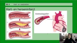 Basisstof 5 Hart en vaatziekten [upl. by Hester]