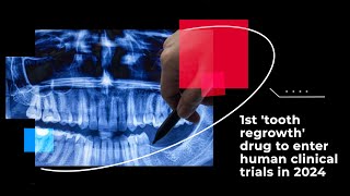 1st tooth regrowth drug to enter human clinical trials in 2024 [upl. by Ephrayim34]