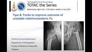 TOTAC2021 Ep2 Part 410 Tips amp Tricks for unstable intertrochanteric Fx By DrTheerachai CMU [upl. by Yznyl709]