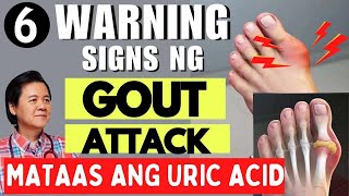 6 Warning Signs ng Gout Attack  By Doc Willie Ong Internist and Cardiologist [upl. by Whorton760]