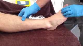 DryNeedling Extensor Hallucis Longus [upl. by Biddie663]