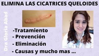 CICATRICES QUELOIDES ▶ Causas prevención y tratamientos ✅ [upl. by Boyd]