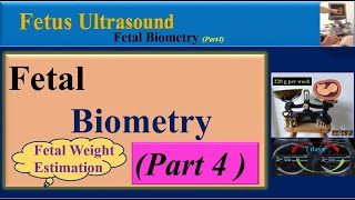 Fetus Ultrasound  Fetal Biometry Part4  Fetal Weight Estimation [upl. by Elle417]