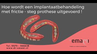 Complete implantaat behandeling frictie steg prothese [upl. by Neehs]