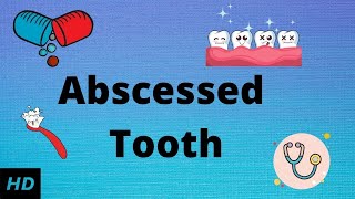 Abscessed tooth Causes SIgns and Symptoms Diagnosis and Treatment [upl. by Erdei]