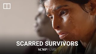 India’s women rise up after acid attacks [upl. by Mell639]