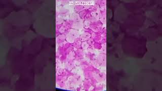 Squamous epithelial cells microscope slide🔬shortvideo youtube [upl. by Akinek]