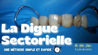 La digue dentaire sectorielle Une méthode simple et rapide [upl. by Terrene]