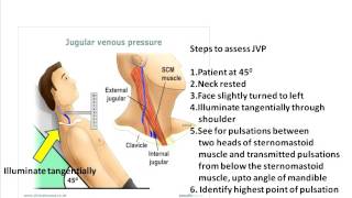 Jugular venous pulse clinical aspects [upl. by Grossman]