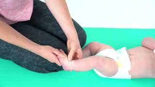 Baby Development  Talipes  Transverse Foot Massage [upl. by Omlesna]