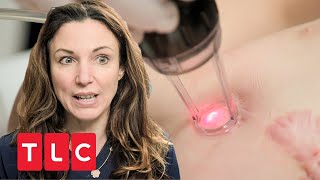 Laserbehandlung für Kind  Dr Emma Hautärztin aus Leidenschaft  TLC Deutschland [upl. by Ahsenik582]