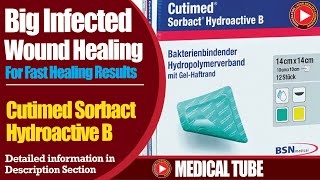 Infected Wound Care with Cutimed Sorbact Hydroactive [upl. by Etnauq360]