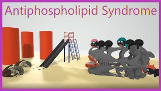 Antiphospholipid Syndrome Mnemonic for the USMLE [upl. by Keisling]