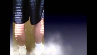 Gait Case in a Triathlete Arm Swing amp Limping Gait Patterns [upl. by Susejedesoj]