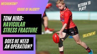 Navicular Stress Fracture Essendon Bombers Tom Hird  Injury Analysis [upl. by Phelgon]