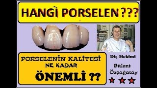 Hangi Porselen Porselenin Kalitesi Dişlerdeki Çalışma Teknikleri [upl. by Nabroc536]