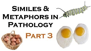 SIMILES AND METAPHORS IN PATHOLOGY PART 3 [upl. by Eciuqram6]