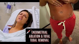 SURGERY DAY ENDOMETRIAL ABLATION amp TUBES REMOVED  PART 1 [upl. by Achorn]