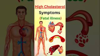 STOP Ignoring These Warning Signs of High Cholesterol [upl. by Fishbein]