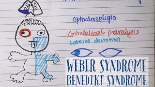 NeuroAnatomy Clinicals 5 Mid Brain ❘ Weber Syndrome amp Benedikt Syndrome with interesting Drawings [upl. by Atirec116]