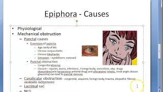 Ophthalmology 399 a Epiphora [upl. by Esereht]