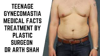 Teenage Gynecomastia Medical facts and Treatment options explained by Plastic Surgeon Dr Arth Shah [upl. by Kylila]