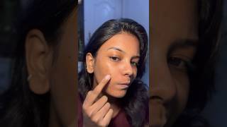 Pimple drying solution review Remove pimple in just 2 days acne acnetreatment [upl. by Eivlys]