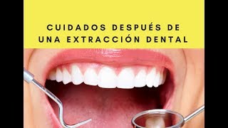 Cuidados después de una extracción dental [upl. by Carolin780]