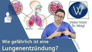 Lungenentzündung Wie gefährlich ist die Pneumonie Hygiene amp Prophylaxe sowie Symptome amp Therapie❗ [upl. by Miguela]