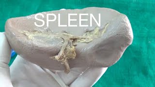 SPLEEN  Demonstration Anatomy [upl. by Etnom]