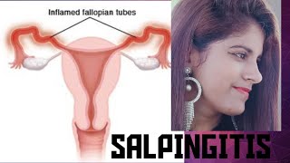 SALPINGITIS in hindi salpingitis salpingitiscauses inflammationofoviduct [upl. by Timoteo935]